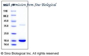 Sino Biological 12091-H08H image 1