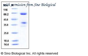 Sino Biological 50464-M02H image 1