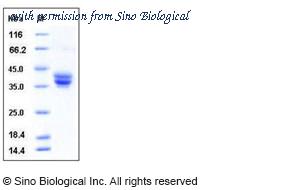 Sino Biological 50559-M08H image 1