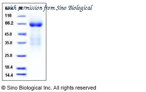 Sino Biological 50504-M08H image 1