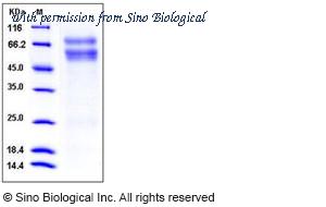Sino Biological 50577-M07H image 1