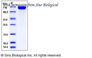Sino Biological 11760-H07H image 1