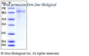 Sino Biological 11171-H08H image 1