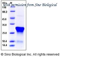Sino Biological 11841-H07E image 1