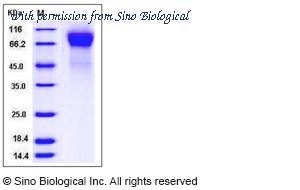 Sino Biological 13029-V08H image 1
