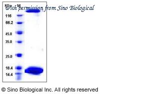 Sino Biological 12472-H08E image 1