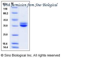 Sino Biological 11277-H08H image 1