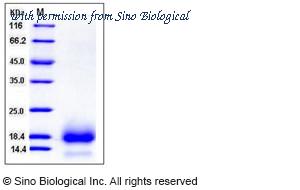 Sino Biological 12474-H08H image 1
