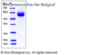 Sino Biological 11960-H08H image 1