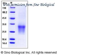 Sino Biological 12275-H08H image 1