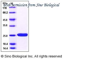 Sino Biological 12656-HNAE image 1