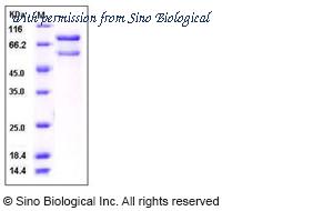 Sino Biological 11738-H20B image 1