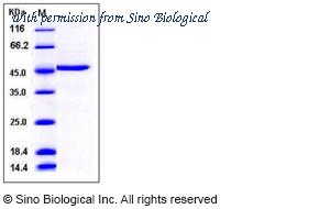 Sino Biological 12463-HNCE image 1