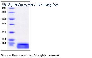 Sino Biological 10898-H08E image 1