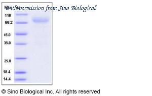 Sino Biological 11843-H02H image 1