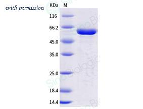 Sino Biological 10570-H20B image 1