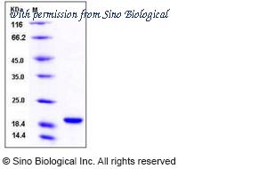 Sino Biological 10436-H08E image 1
