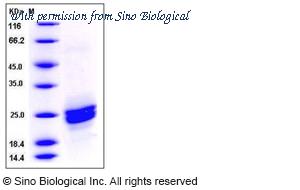 Sino Biological 50689-M08H image 1