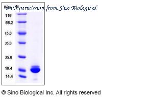 Sino Biological 11263-H07E image 1