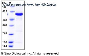 Sino Biological 11383-H20B image 1