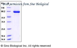 Sino Biological 11551-H20B image 1