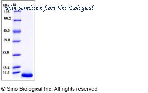 Sino Biological 10325-HNAB image 1