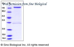 Sino Biological 12589-H02H image 1