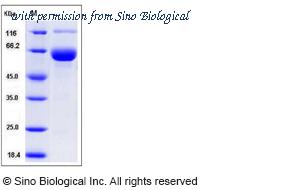 Sino Biological 50712-M02H image 1