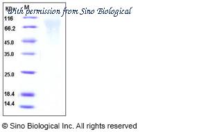 Sino Biological 11070-V08H2 image 1
