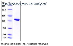 Sino Biological 12578-H09E image 1