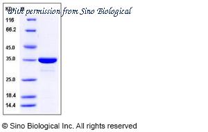 Sino Biological 10437-H09E image 1