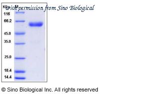 Sino Biological 50699-M02H image 1