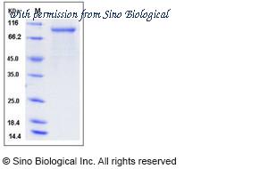 Sino Biological 10218-H08H image 1