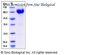 Sino Biological 50846-M02H image 1