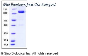 Sino Biological 51004-M02H image 1