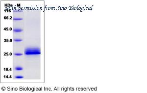 Sino Biological 13648-H33H image 1