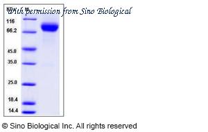 Sino Biological 12136-H02H image 1