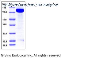 Sino Biological 11307-H20B image 1