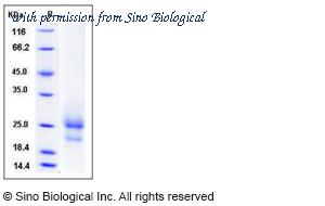 Sino Biological 51005-M08H image 1