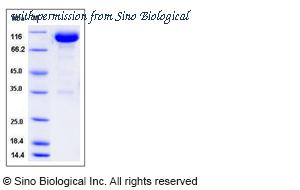 Sino Biological 50960-M02H image 1