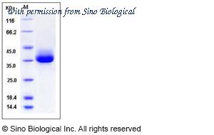 Sino Biological 11456-H08H image 1