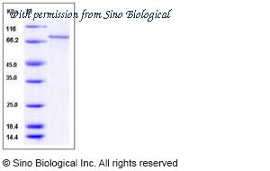 Sino Biological 13148-H20B image 1