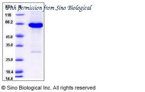 Sino Biological 13149-H20B image 1