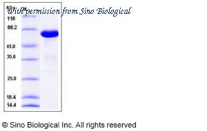 Sino Biological 11161-H08E image 1