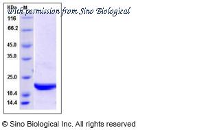 Sino Biological 12892-HNCE image 1