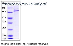 Sino Biological 10161-H20B1 image 1