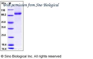 Sino Biological 10616-H20B1 image 1