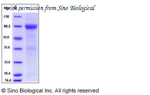 Sino Biological 13223-H02H image 1