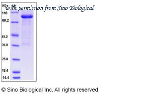 Sino Biological 13228-H02H image 1