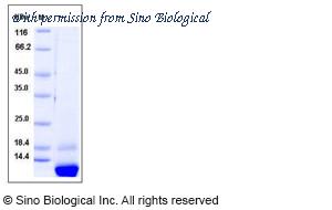 Sino Biological 10898-H08E1 image 1